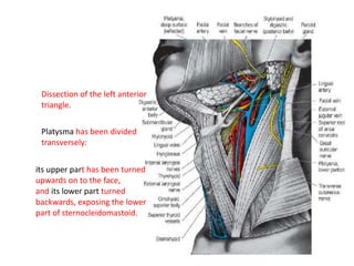 Dissection of the left anterior
triangle.
Platysma has been divided
transversely:
its upper part has been turned
upwards on to the face,
and its lower part turned
backwards, exposing the lower
part of sternocleidomastoid.
 