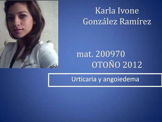 Karla Ivone
   González Ramírez


 mat. 200970
    OTOÑO 2012
Urticaria y angoiedema
 