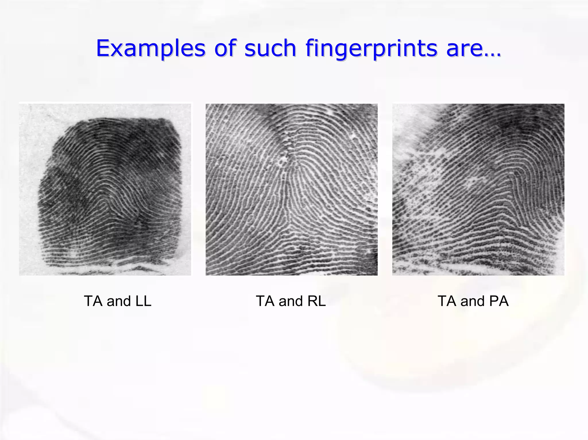 Examples of such fingerprints are…
TA and LL 
TA and RL 
TA and PA  