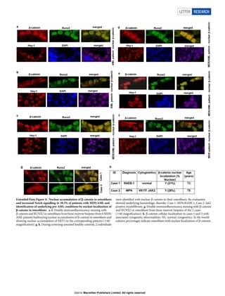 Extended Data Figure 8 | Nuclear accumulation of b-catenin in osteoblasts
and increased Notch signalling in 38.3% of patients with MDS/AML and
identification of underlying pre-AML conditions by nuclear localization of
b-catenin in osteoblasts. a–f, Double immunofluorescence staining with
b-catenin and RUNX2 in osteoblasts from bone marrow biopsies from 6 MDS/
AML patients harbouring nuclear accumulation of b-catenin in osteoblasts and
showing nuclear accumulation of HEY1 in the corresponding patients (360
magnification). g, h, During screening assumed healthy controls, 2 individuals
were identified with nuclear b-catenin in their osteoblasts. Re-evaluation
showed underlying hematologic disorder, Case 1: MDS RAEB-1, Case 2: Jak2
positive myelofibrosis. g, Double immunofluorescence staining with b-catenin
and RUNX2 in osteoblasts from bone marrow biopsies of the 2 cases
(360 magnification). h, b-catenin cellular localization in cases 1 and 2 with
associated cytogenetic abnormalities. NL: normal cytogenetics. In the fourth
column percentages indicate osteoblasts with nuclear localization of b-catenin.
LETTER RESEARCH
Macmillan Publishers Limited. All rights reserved©2014
 