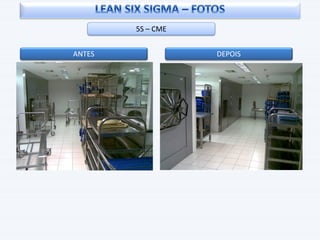 5S – CME
ANTES DEPOIS
 
