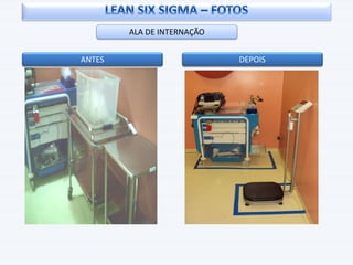 ALA DE INTERNAÇÃO
ANTES DEPOIS
 