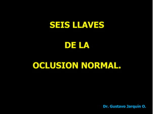 SEIS LLAVES
DE LA
OCLUSION NORMAL.
Dr. Gustavo Jarquín O.
 