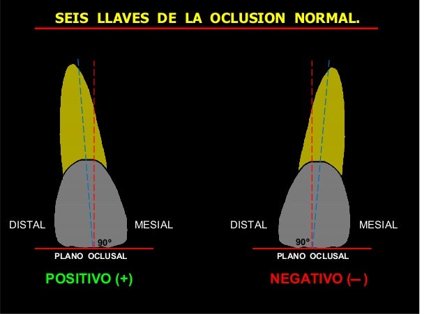 80518551 seis-llaves-de-la-oclusion-normal (1) 2015