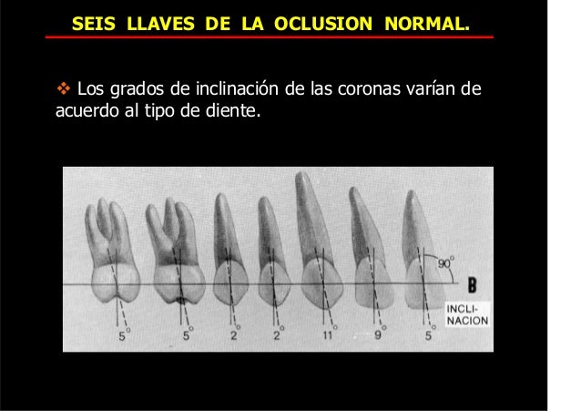 80518551 seis-llaves-de-la-oclusion-normal (1) 2015