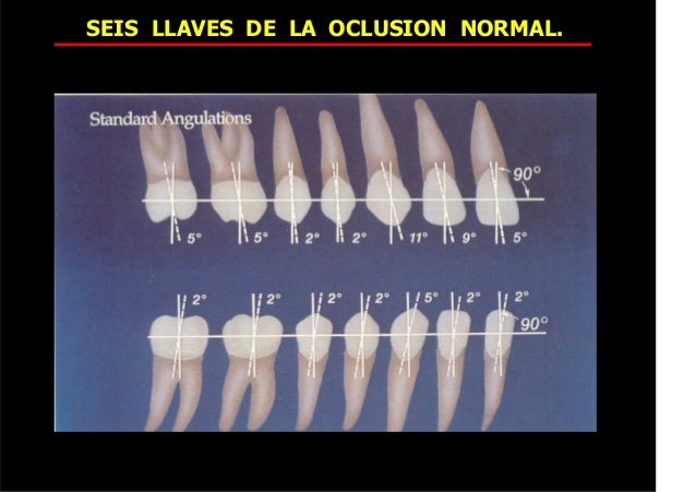 80518551 seis-llaves-de-la-oclusion-normal (1) 2015