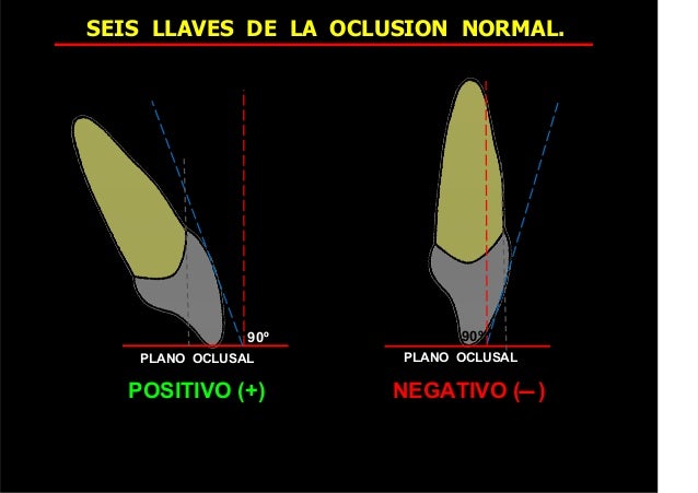80518551 seis-llaves-de-la-oclusion-normal (1) 2015