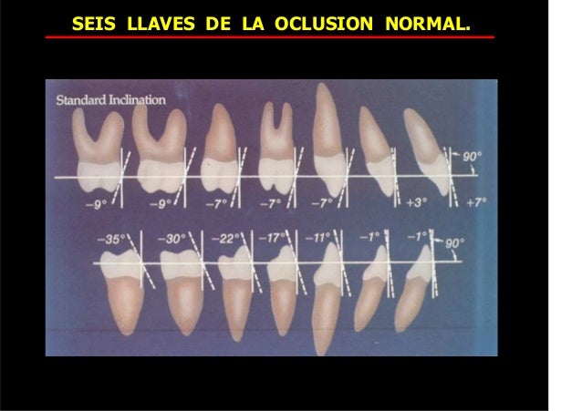 80518551 seis-llaves-de-la-oclusion-normal (1) 2015