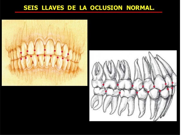 80518551 seis-llaves-de-la-oclusion-normal (1) 2015