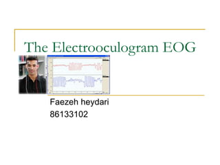 The Electrooculogram EOG
Faezeh heydari
86133102
 