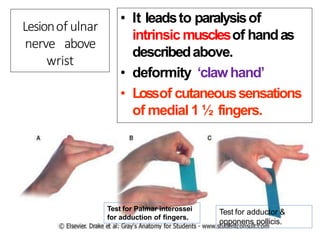 • It leadsto paralysisof
intrinsic musclesof handas
describedabove.
• deformity ‘clawhand’
• Lossof cutaneoussensations
of medial 1 ½ fingers.
Lesionof ulnar
nerve above
wrist
Test for Palmar interossei
for adduction of fingers.
Test for adductor &
opponens pollicis.
 