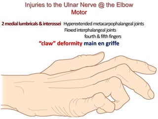 Injuries to the Ulnar Nerve @ the Elbow
Motor
2mediallumbricals&interossei Hyperextendedmetacarpophalangealjoints
Flexedinterphalangealjoints
fourth&fifthfingers
“claw” deformity main en griffe
 
