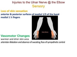 Loss of skin sensation
anterior & posterior surfaces of medial 1/3 of the hand
medial 1 ½ fingers
Vasomotor Changes
warmer and drier skin area
arteriolardilatationandabsenceofsweating/lossofsympatheticcontrol
Injuries to the Ulnar Nerve @ the Elbow
Sensory
 