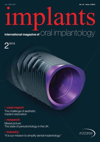 22015
implantsinternational magazine of oral implantology
issn 1868-3207 Vol. 16 • Issue 2/2015
| case report
The challenge of aesthetic
implant restoration
| research
Mixed picture:
The state of periodontology in the UK
| industry
“It is our mission to simplify dental implantology”
 