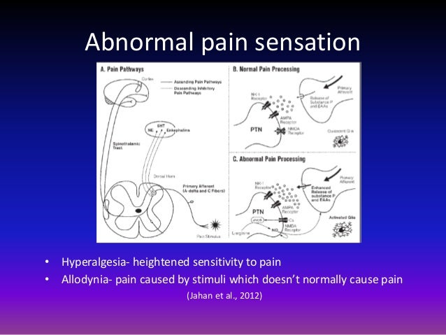 Fibromyalgia powerpoint completed Fibromyalgia powerpoint completed