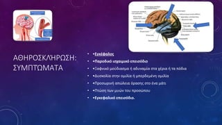 ΑΘΗΡΟΣΚΛΉΡΩΣΗ:
ΣΥΜΠΤΏΜΑΤΑ
• •Εγκέφαλος
• •Παροδικό ισχαιμικό επεισόδιο
• •Ξαφνικό μούδιασμα ή αδυναμία στα χέρια ή τα πόδια
• •Δυσκολία στην ομιλία ή μπερδεμένη ομιλία
• •Προσωρινή απώλεια όρασης στο ένα μάτι
• •Πτώση των μυών του προσώπου
• •Εγκεφαλικό επεισόδιο.
 