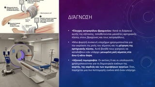 ΔΙΆΓΝΩΣΗ
• •Έλεγχος αστραγάλου-βραχιονίου: Κατά τη διάρκεια
αυτής της εξέτασης, τοποθετούνται μανσέτες αρτηριακής
πίεσης στους βραχίονες και τους αστραγάλους.
• •Μια φορητή συσκευή υπερήχων χρησιμοποιείται για
την ακρόαση της ροής του αίματος και τη μέτρηση της
αρτηριακής πίεσης. Αυτό βοηθά τους γιατρούς να
καταλάβουν εάν υπάρχει μειωμένη ροή αίματος στα
άνω ή κάτω άκρα.
• •Αξονική τομογραφία: Οι ακτίνες Χ και οι υπολογιστές
χρησιμοποιούνται για τη δημιουργία εικόνων της
αορτής, της καρδιάς και των αιμοφόρων αγγείων. Έτσι,
παρέχεται μια πιο λεπτομερής εικόνα από έναν υπέρηχο.
 