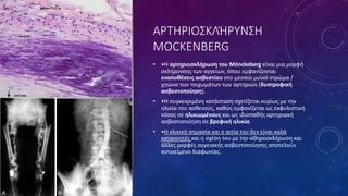 ΑΡΤΗΡΙΟΣΚΛΉΡΥΝΣΗ
MOCKENBERG
• •Η αρτηριοσκλήρωση του Mönckeberg είναι μια μορφή
σκλήρυνσης των αγγείων, όπου εμφανίζονται
εναποθέσεις ασβεστίου στο μεσαίο μυϊκό στρώμα /
χιτώνα των τοιχωμάτων των αρτηριών (δυστροφική
ασβεστοποίηση).
• •Η συγκεκριμένη κατάσταση σχετίζεται κυρίως με την
ηλικία του ασθενούς, καθώς εμφανίζεται ως εκφυλιστική
νόσος σε ηλικιωμένους και ως ιδιοπαθής αρτηριακή
ασβεστοποίηση σε βρεφική ηλικία.
• •Η κλινική σημασία και η αιτία του δεν είναι καλά
κατανοητές και η σχέση του με την αθηροσκλήρωση και
άλλες μορφές αγγειακής ασβεστοποίησης αποτελούν
αντικείμενο διαφωνίας.
 