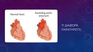 TΙ ΔΙΑΦΟΡΆ
ΠΑΡΑΤΗΡΕΊΤΕ;
 