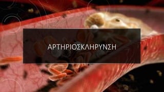 ΑΡΤΗΡΙΟΣΚΛΗΡΥΝΣΗ
 