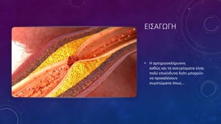 ΕΙΣΑΓΩΓΗ
• Η αρτηριοσκλήρυσνη
καθώς και τα ανευρίσματα είναι
πολύ επικίνδυνα διότι μπορούν
να προκαλέσουν
συμπτώματα όπως...
 