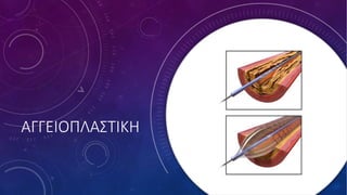 ΑΓΓΕΙΟΠΛΑΣΤΙΚΗ
 