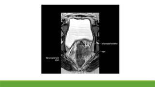 MRI OF the PELVIC FLOOr image anatomy.pptx