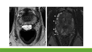 MRI OF the PELVIC FLOOr image anatomy.pptx