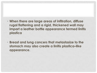 • When there are large areas of infitration, diffuse
  rugal flattening and a rigid, thickened wall may
  impart a leather bottle appearance termed linitis
  plastica

• Breast and lung cancers that metastasize to the
  stomach may also create a linitis plastica–like
  appearance.
 