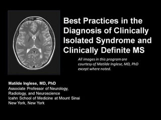 Clinically Isolated Syndrome & Clinically Definite Multiple Sclerosis