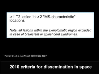 Clinically Isolated Syndrome & Clinically Definite Multiple Sclerosis