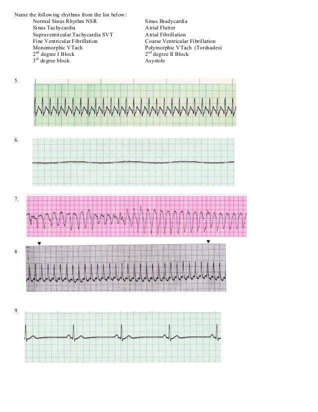 Ecg For Acls