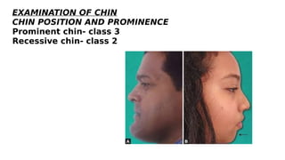 Chin Principles Diagnostic-aids-in-orthodontics clinical practiceppt.pdf