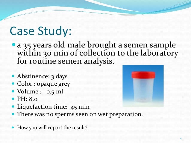 sperm Analysis of