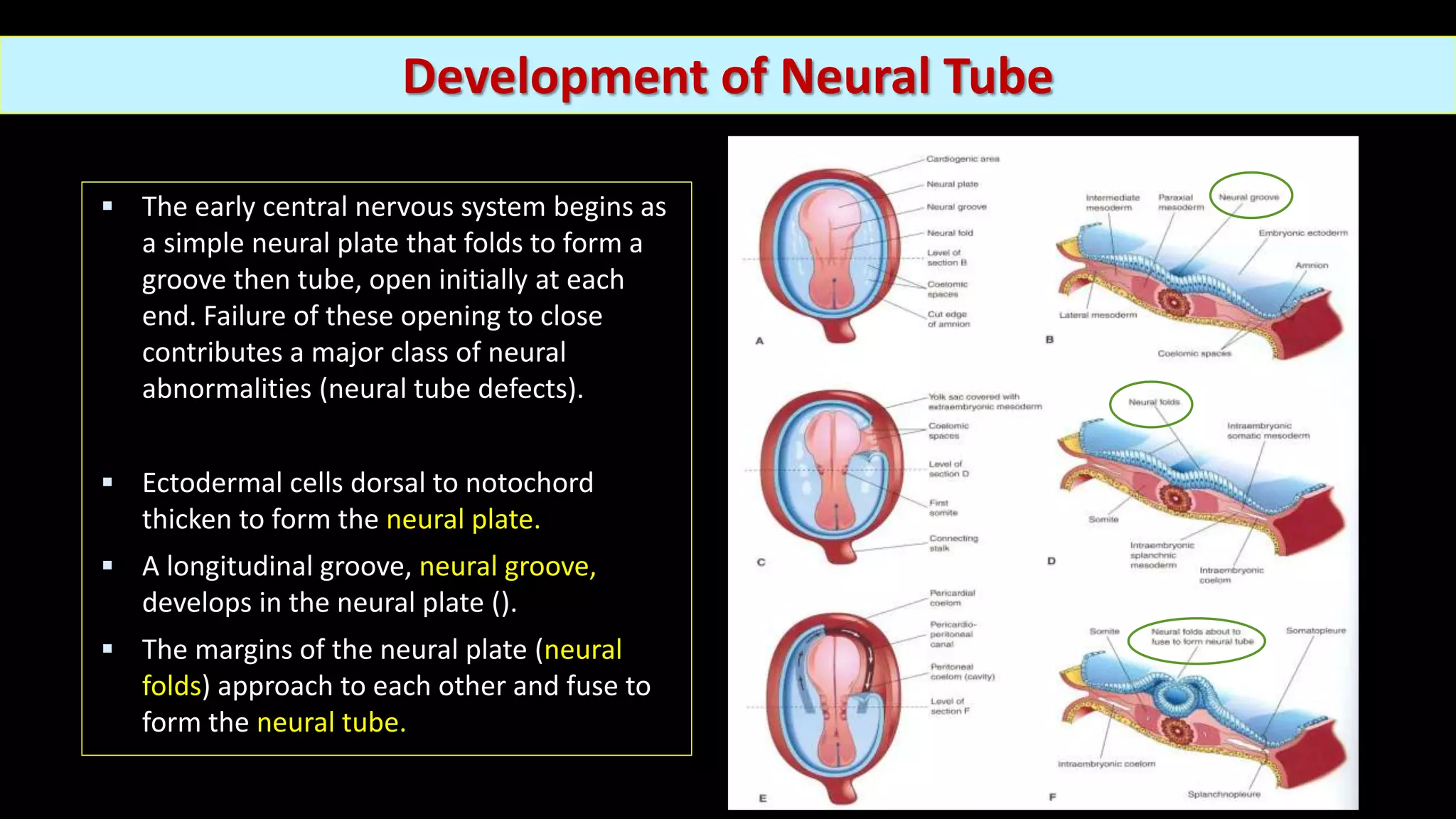 Embryology and Development of Spinal Dysraphism and Tethered Spinal ...