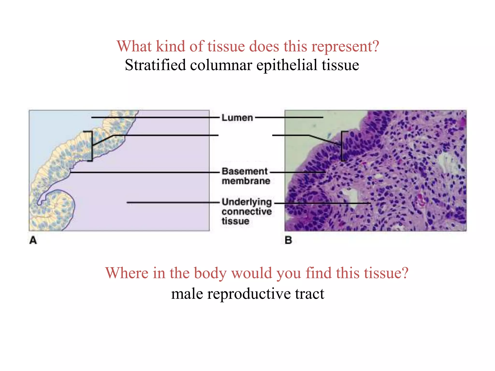 What kind of tissue does this represent?
Where in the body would you find this tissue?
Stratified columnar epithelial tissue
male reproductive tract
 