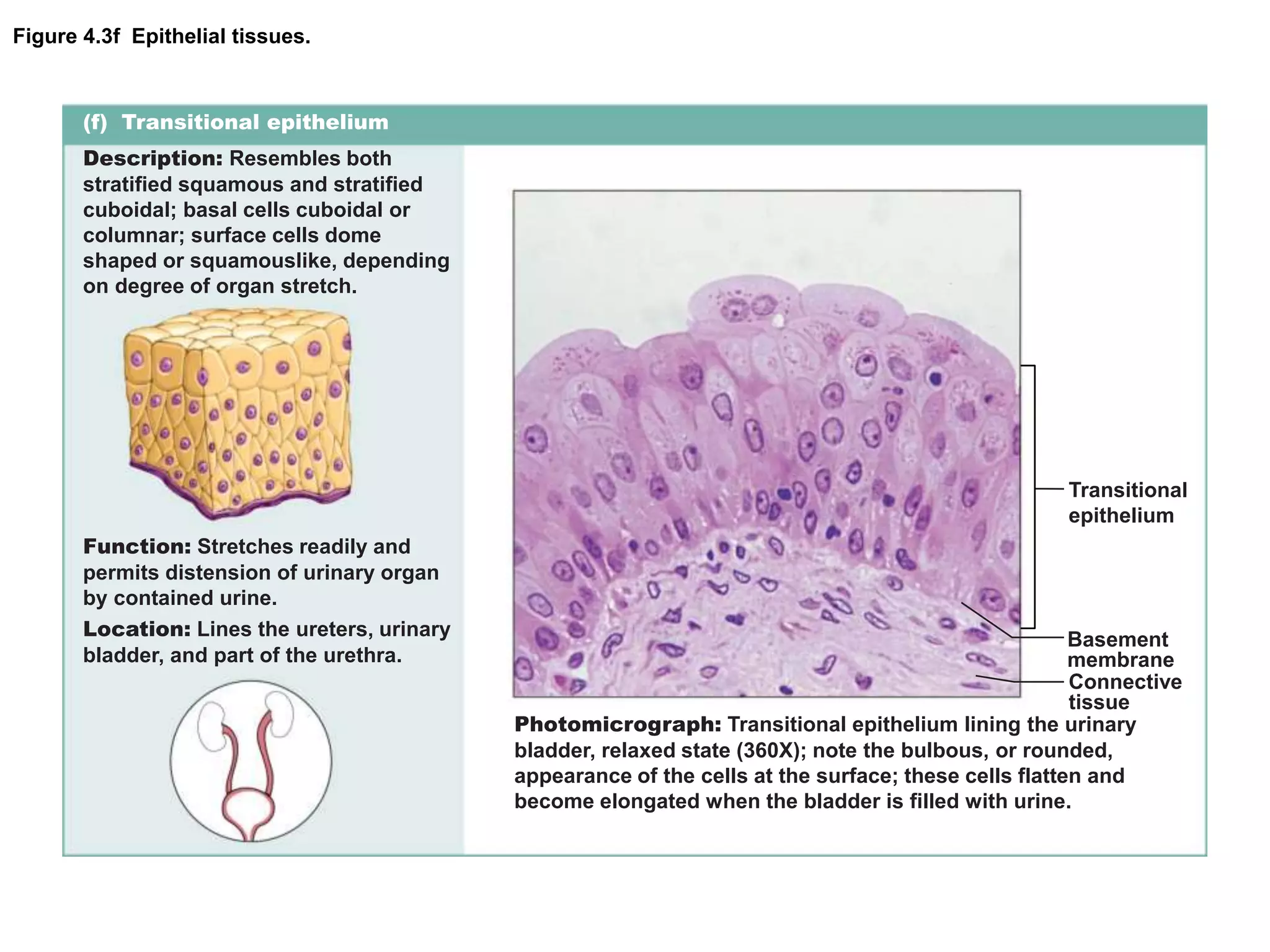 Figure 4.3f Epithelial tissues.
(f) Transitional epithelium
Description: Resembles both
stratified squamous and stratified
cuboidal; basal cells cuboidal or
columnar; surface cells dome
shaped or squamouslike, depending
on degree of organ stretch.
Function: Stretches readily and
permits distension of urinary organ
by contained urine.
Location: Lines the ureters, urinary
bladder, and part of the urethra.
Photomicrograph: Transitional epithelium lining the urinary
bladder, relaxed state (360X); note the bulbous, or rounded,
appearance of the cells at the surface; these cells flatten and
become elongated when the bladder is filled with urine.
Basement
membrane
Connective
tissue
Transitional
epithelium
 