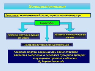 Холецистэктомия
Главным этапом операции при обеих способах
является выделение и перевязка пузырной артерии
и пузырного протока в области
lig.hepatoduodenale
Показания: желчекаменная болезнь, опухоли желчного пузыря
Удаление желчного пузыря
от шейки
Удаление желчного пузыря
от дна
Способы
Лапароскопическая холецистэктомия
 