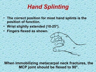 Hand Splinting
• The correct position for most hand splints is the
position of function.
• Wrist slightly extended (10-25°).
• Fingers flexed as shown.
When immobilizing metacarpal neck fractures, the
MCP joint should be flexed to 90°.
 
