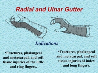 Radial and Ulnar Gutter
•Fractures, phalangeal
and metacarpal, and soft
tissue injuries of the little
and ring fingers.
•Fractures, phalangeal
and metacarpal, and soft
tissue injuries of index
and long fingers.
Indications
 