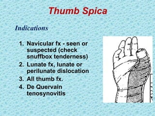 Thumb Spica
1. Navicular fx - seen or
suspected (check
snuffbox tenderness)
2. Lunate fx, lunate or
perilunate dislocation
3. All thumb fx.
4. De Quervain
tenosynovitis
Indications
 