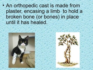 • An orthopedic cast is made from
plaster, encasing a limb to hold a
broken bone (or bones) in place
until it has healed.
 