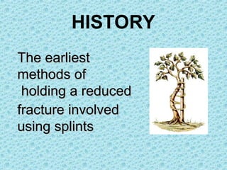 The earliest
The earliest
methods of
methods of
holding a reduced
holding a reduced
fracture involved
fracture involved
using splints
using splints
HISTORY
 