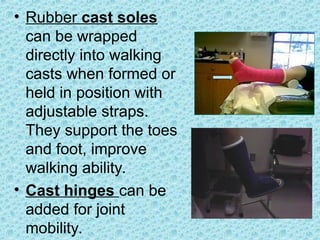 • Rubber cast soles
can be wrapped
directly into walking
casts when formed or
held in position with
adjustable straps.
They support the toes
and foot, improve
walking ability.
• Cast hinges can be
added for joint
mobility.
 