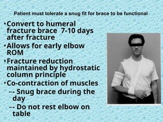 Patient must tolerate a snug fit for brace to be functional
•Convert to humeral
fracture brace 7-10 days
after fracture
•Allows for early elbow
ROM
•Fracture reduction
maintained by hydrostatic
column principle
•Co-contraction of muscles
–- Snug brace during the
day
–- Do not rest elbow on
table
 
