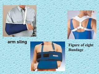 Figure of eight
Bandage
arm sling
 