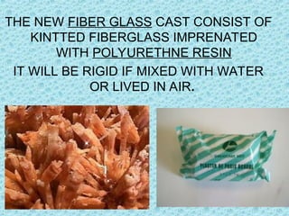 THE NEW FIBER GLASS CAST CONSIST OF
KINTTED FIBERGLASS IMPRENATED
WITH POLYURETHNE RESIN
IT WILL BE RIGID IF MIXED WITH WATER
OR LIVED IN AIR.
 