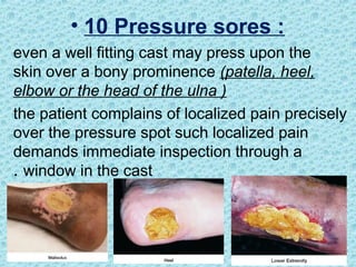 • 10 Pressure sores :
even a well fitting cast may press upon the
skin over a bony prominence (patella, heel,
elbow or the head of the ulna )
the patient complains of localized pain precisely
over the pressure spot such localized pain
demands immediate inspection through a
window in the cast
.
 