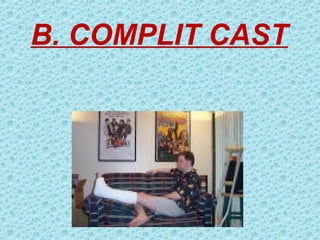B. COMPLIT CAST
 