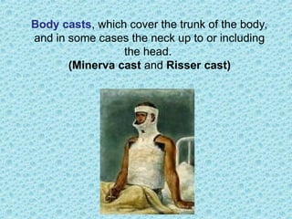 Body casts, which cover the trunk of the body,
and in some cases the neck up to or including
the head.
(Minerva cast and Risser cast)
 